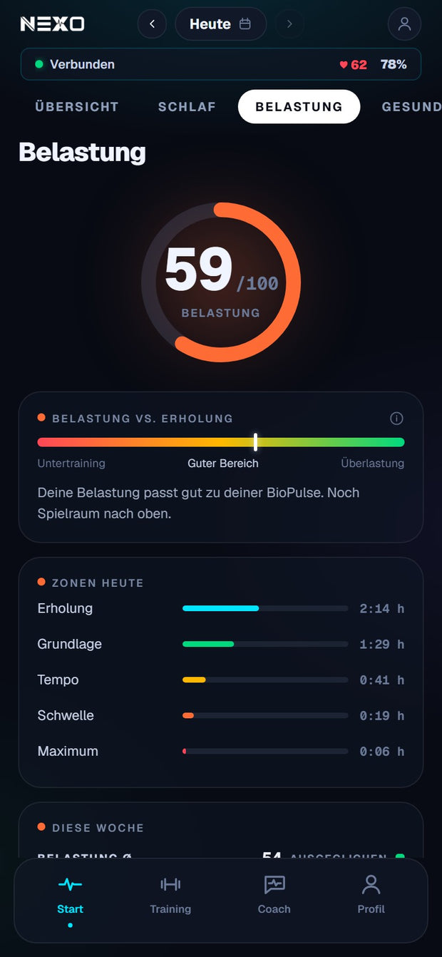 Belastungsansicht mit Zonenverteilung